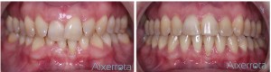 Gracias a la ortodoncia podemos conseguir que tus dientes estén alineados y que luzcas una bonita sonrisa