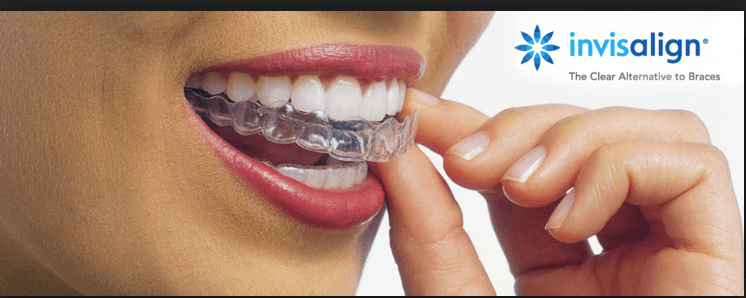 ortodoncia invisalign